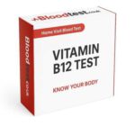 Vitamin B12 Blood Test Guide for Wakefield Residents